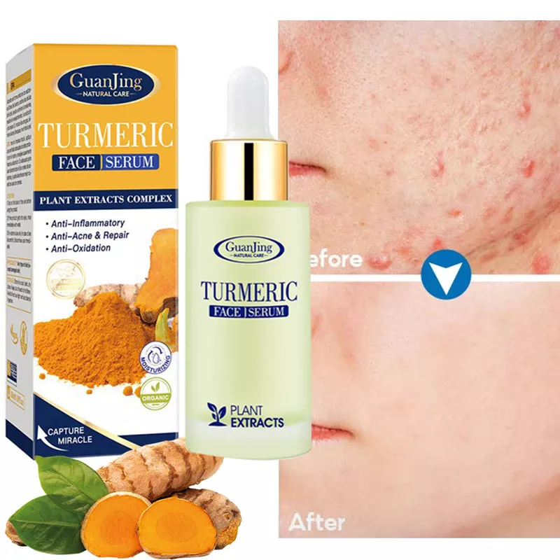 Turmeric Face Serum Clears Acne, Wrinkles & Repairs Skin